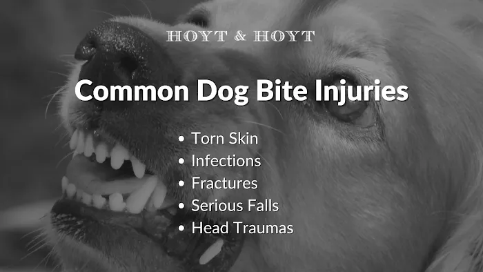 Hoyt & Hoyt 4