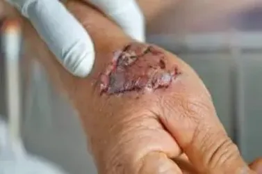 Brach Eichler Injury Lawyers 5