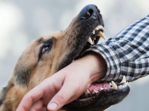 Best Lawyer for Dog Bite Lawsuit: What You Need to Know