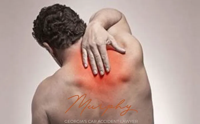 Murphy Law Georgia's Car Accident Lawyer 4