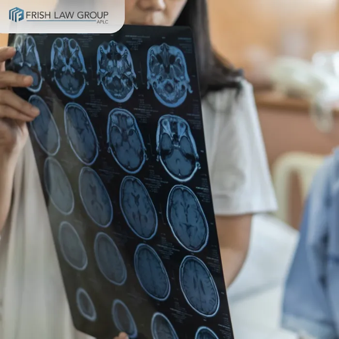 Frish Law Group, APLC | Personal Injury Attorneys LA 5