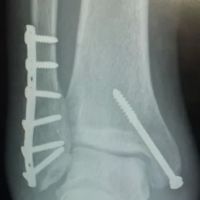 Casey W. Stevens Personal Injury Law: Accident & Injury Lawyer Dawsonville, GA ico