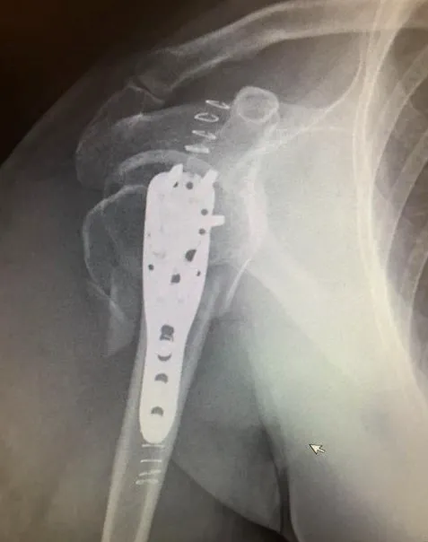 Scottsdale Injury Lawyers LLC 5