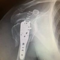 Scottsdale Injury Lawyers LLC ico