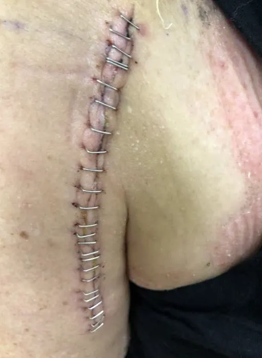 Scottsdale Injury Lawyers LLC 5