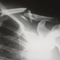 Attorney Daniel A. Pava, Accident Lawyer Springfield MA ico