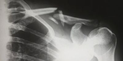 Attorney Daniel A. Pava, Accident Lawyer Springfield MA